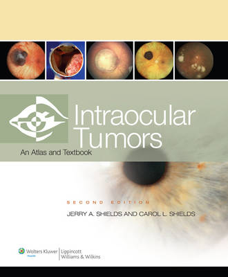 Intraocular Tumors - Jerry A. Shields, Dr. Carol L. Shields