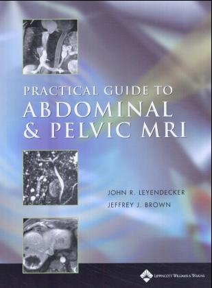 Practical Guide to Abdominal and Pelvic MRI - John R. Leyendecker, Jeffrey J. Brown