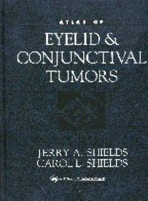 Atlas of Eyelid and Conjunctival Tumors - Jerry A. Shields, Dr. Carol L. Shields