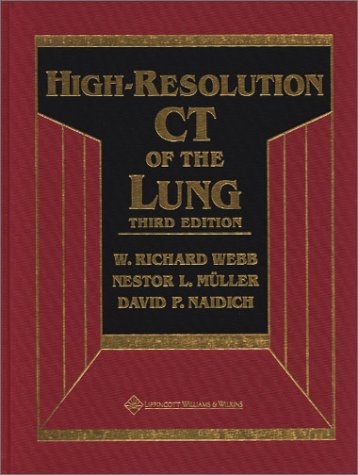 High Resolution CT of the Lung - W.Richard Webb, Nestor L. Muller, David P. Naidich