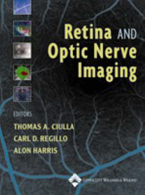 Retina and Optic Nerve Imaging - Thomas A. Ciulla, Carl D. Regillo