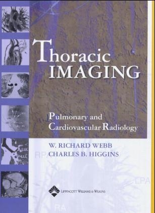 Thoracic Imaging - Charles B. Higgins, W.Richard Webb