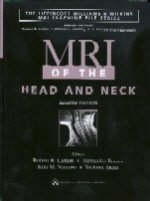 MRI of the Head and Neck - Alexandra Borges, Kim N. Nguyen, Yoshimi Anzai