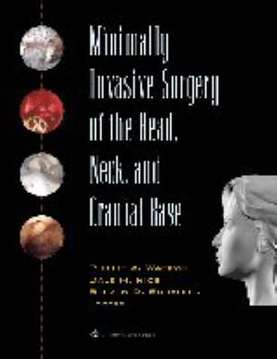 Minimally Invasive Surgery of the Head, Neck, and Cranial Base - 