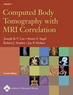 Computed Body Tomography with MRI Correlation - 