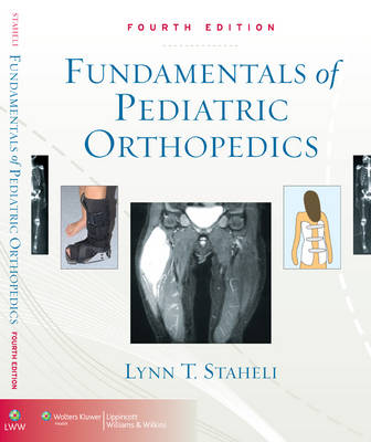 Fundamentals of Pediatric Orthopedics - Lynn T. Staheli