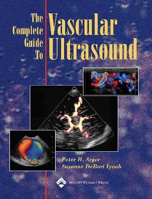 The Complete Guide to Vascular Ultrasound - Peter H. Arger, Suzanne Debari Iyoob