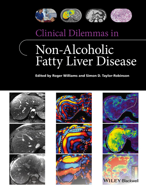 Clinical Dilemmas in Non-Alcoholic Fatty Liver Disease - Roger Williams, Simon D. Taylor-Robinson