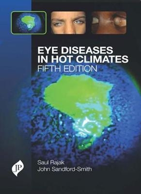 Eye Diseases in Hot Climates - Saul N Rajak, John Sandford-Smith