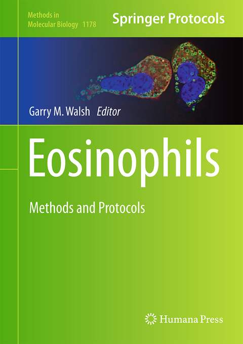 Eosinophils - 