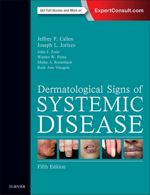 Dermatological Signs of Systemic Disease -  Jeffrey P. Callen,  Joseph L. Jorizzo,  John J. Zone,  Warren Piette,  Misha A. Rosenbach,  Ruth Ann Vleu