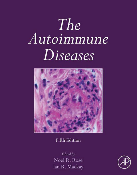 Autoimmune Diseases - 