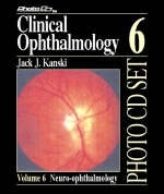 Clinical Ophthalmology - Jack J. Kanski