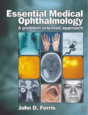 Essential Medical Ophthalmology - John D. Ferris