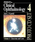 Clinical Ophthalmology - Jack J. Kanski