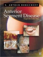 Anterior Segment Disorder - S.Arthur Boruchoff