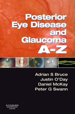 Posterior Eye Disease and Glaucoma A-Z - Adrian S. Bruce, Justin O'Day, Daniel McKay, Peter G. Swann