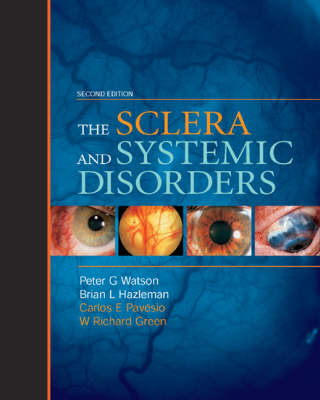 The Sclera and Systemic Disorders - Peter Watson, Brian L. Hazleman, Carlos E. Pavesio, W. Richard Green