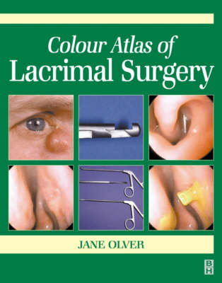 Colour Atlas of Lacrimal Surgery - Jane Olver