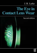 Eye in Contact Lens Wear - 