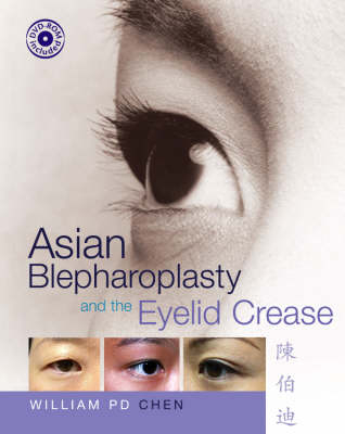 Asian Blepharoplasty and the Eyelid Crease - William P. Chen