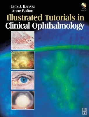 Illustrated Tutorials in Clinical Ophthalmology - Jack J. Kanski, Anne Bolton