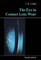 The Eye in Contact Lens Wear - 