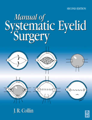 Manual of Systematic Eyelid Surgery - J.R.O. Collin