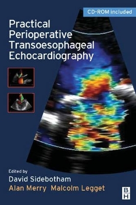 Practical Perioperative Transoesophageal Echocardiography - David Sidebotham, Alan Merry, Malcolm Leggett, Gary Bashein