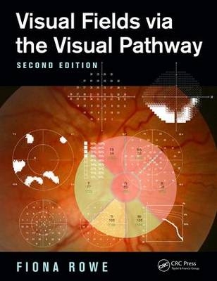 Visual Fields via the Visual Pathway -  Fiona Rowe