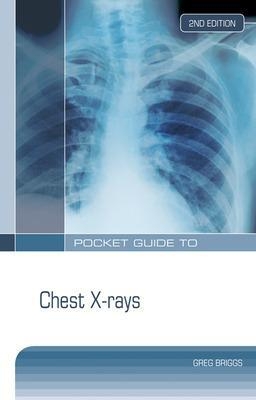 Pocket Guide to Chest X-Rays - Greg Briggs