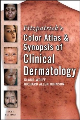 Fitzpatrick's Color Atlas and Synopsis of Clinical Dermatology: Sixth Edition - Klaus Wolff, Richard Johnson