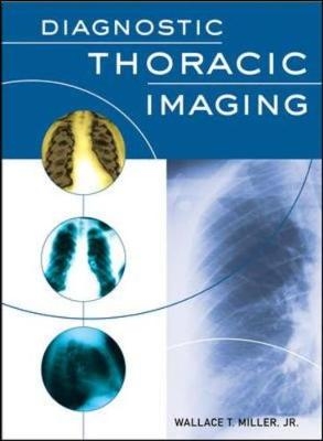 Diagnostic Thoracic Imaging - Wallace Miller