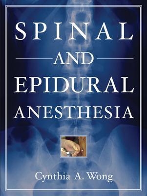 Spinal and Epidural Anesthesia - Cynthia Wong