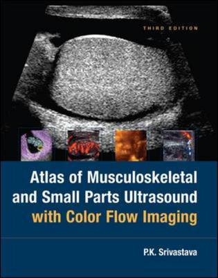 Atlas Of Musculoskeletal and Small Parts Ultrasound with Color Flow Imaging - PK Srivastava