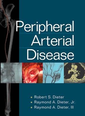 Peripheral Arterial Disease - Robert S Dieter, Raymond Dieter Jr, Raymond Dieter