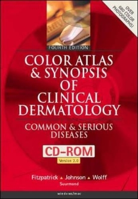 Color Atlas and Synopsis of Clinical Dermatology - 