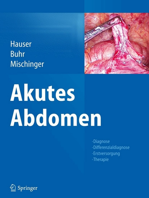 Akutes Abdomen - 