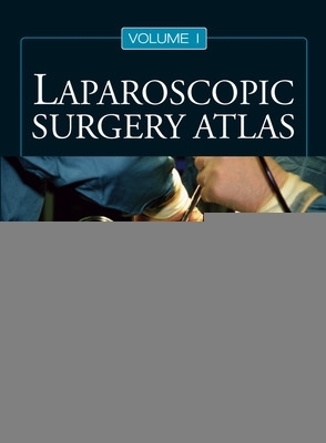 Laparoscopic Surgery Atlas - C. Palanivelu