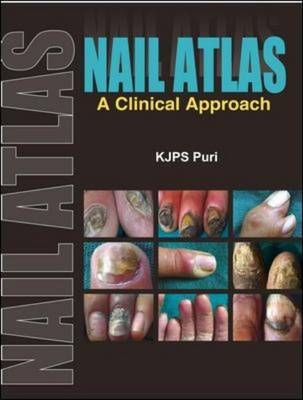 Nail Atlas: A Clinical Approach - K.J.P.S. Puri