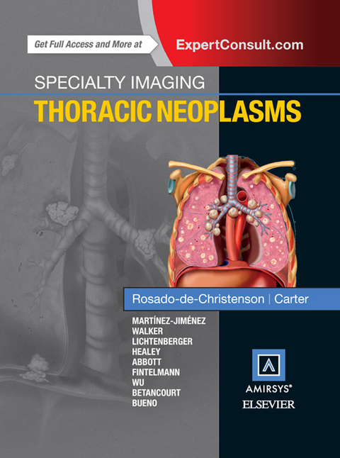 Specialty Imaging: Thoracic Neoplasms E-Book -  Brett W. Carter,  Melissa L. Rosado-de-Christenson