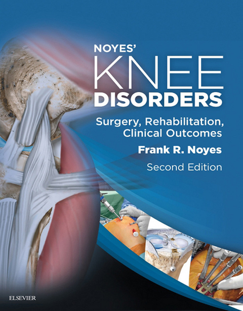 Noyes' Knee Disorders: Surgery, Rehabilitation, Clinical Outcomes E-Book -  Frank R. Noyes