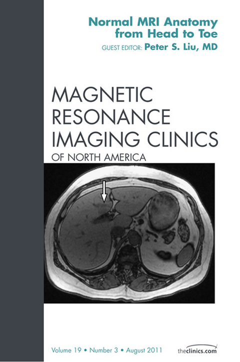 Normal MR Anatomy, An Issue of Magnetic Resonance Imaging Clinics -  Peter S. Liu