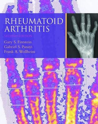 Rheumatoid Arthritis - 