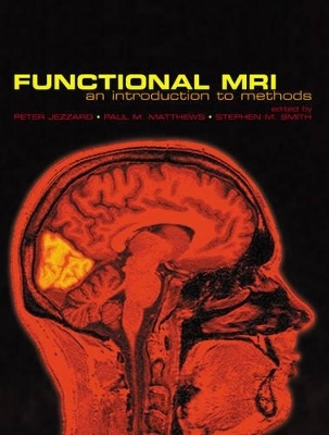 Functional Magnetic Resonance Imaging - 