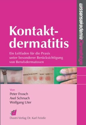 Kontaktdermatitis - Peter Frosch, Axel Schnuch, Wolfgang Uter