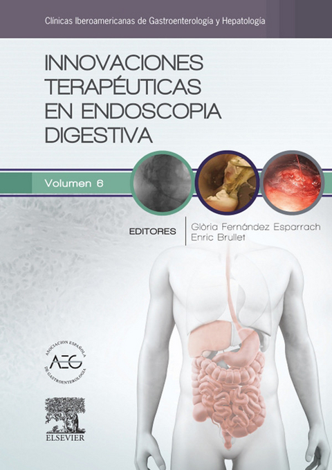 Innovaciones terapéuticas en endoscopia digestiva - 