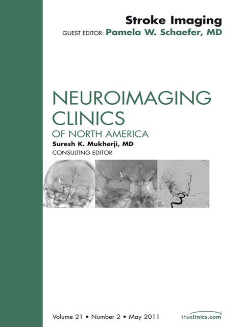 Stroke Imaging Update, An Issue of Neuroimaging Clinics -  Pamela W. Schaefer