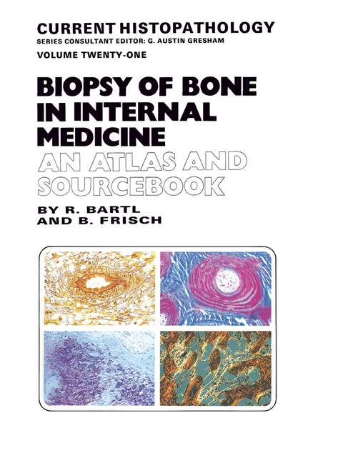 Biopsy of Bone in Internal Medicine: An Atlas and Sourcebook - Reiner Bartl, Bertha Frisch