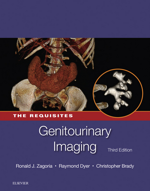 Genitourinary Imaging: The Requisites E-Book -  Christopher M Brady,  Raymond B. Dyer,  Ronald J. Zagoria